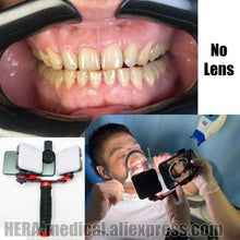 Load image into Gallery viewer, Dental Mobile Phone Flashlight Photography Kit
